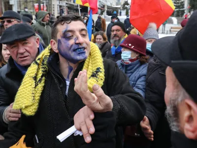 George Simion stropit cu cerneală pe față (sursa: Inquam Photos/Liviu Chirică)