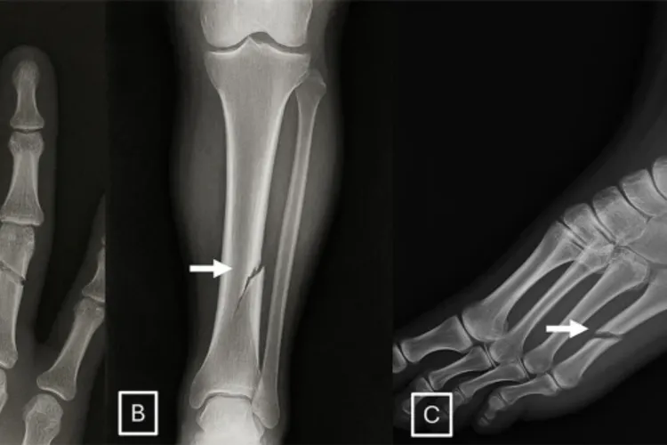 AI poate genera radiologii false (sursa: Radiological Society of North America)