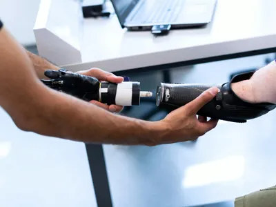 Exporturi germane de proteze către Rusia (sursa: Pexels/ThisIsEngineering)