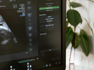 Fertilizare in vitro, după moartea soțului (sursa: Pexels/MART PRODUCTION)