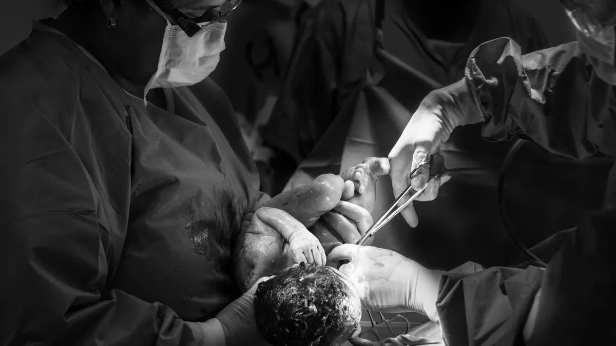 Șocant: cinci cezariene în cinci ani (sursa: Pexels/Jozemara Friorili Lemes)