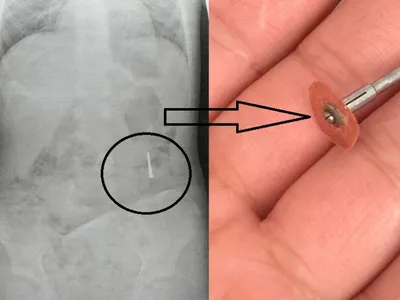 Incident stomatologic grav, copil la urgențe (sursa: ziaruldeiasi.ro)