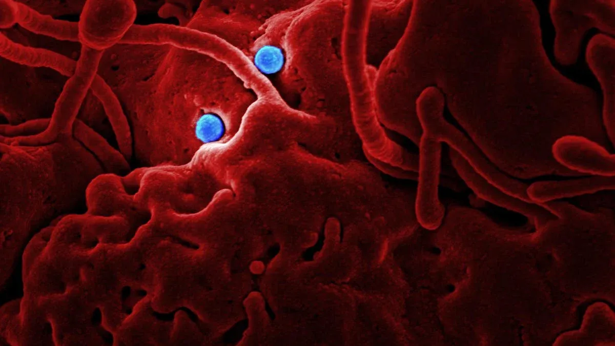 Salmonella, cauză frecventă de toxiinfecție alimentară (sursa: Pexels/CDC)