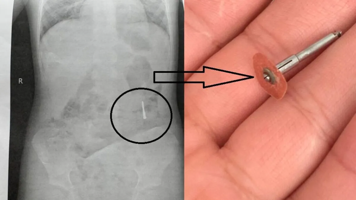 Incident stomatologic grav, copil la urgențe (sursa: ziaruldeiasi.ro)