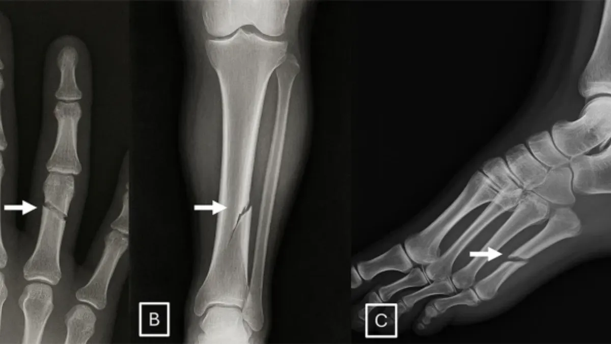 AI poate genera radiologii false (sursa: Radiological Society of North America)
