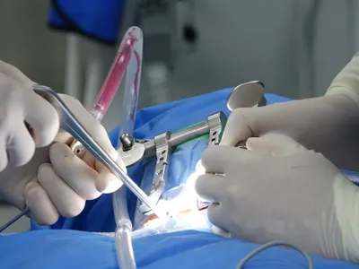 Primul pacient cu transplant cardiac la Iași a murit după o lună: medicii invocă un „cumul de factori”