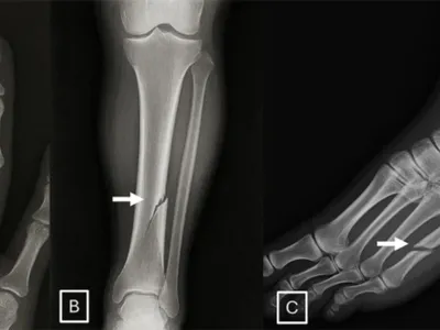 AI poate genera radiologii false (sursa: Radiological Society of North America)