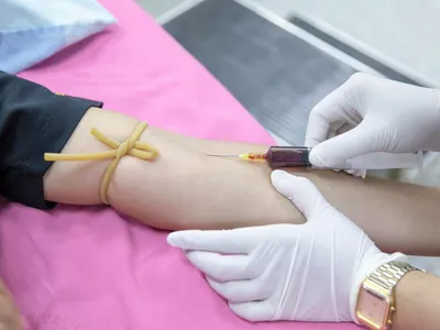 Detectarea cancerului ovarian prin analiza sângelui (sursa: Pexels/Amornthep Srina)