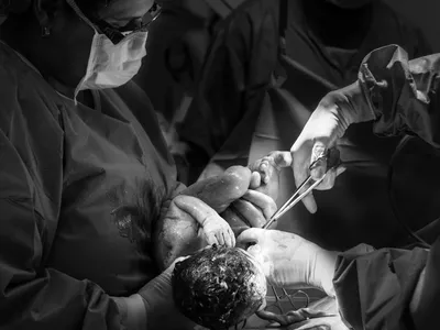 Șocant: cinci cezariene în cinci ani (sursa: Pexels/Jozemara Friorili Lemes)