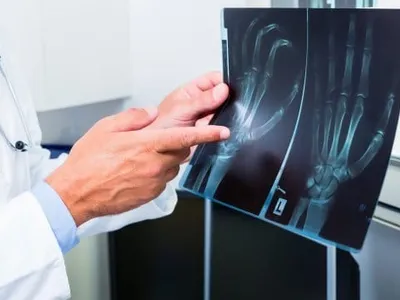 Radiografia disputei violente între foști soți (sursa: ziaruldeiasi.ro)