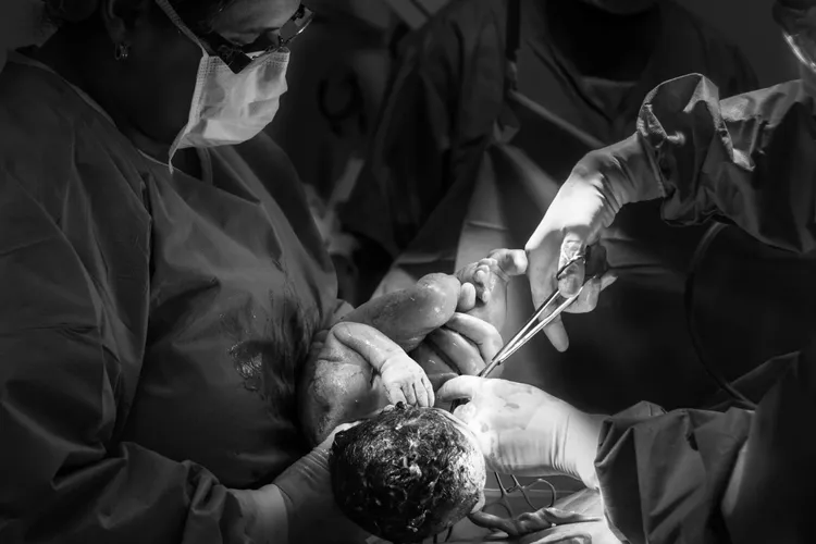 Șocant: cinci cezariene în cinci ani (sursa: Pexels/Jozemara Friorili Lemes)