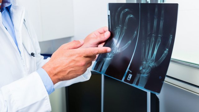 Radiografia disputei violente între foști soți